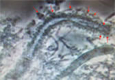 顕微鏡で見た病原菌1