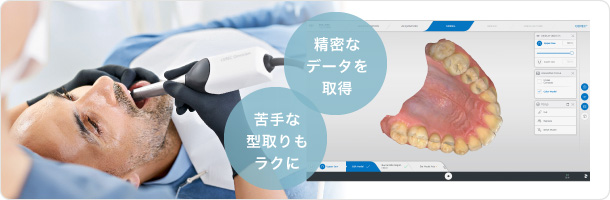 精密なデータを取得、苦手な型取りもラクに